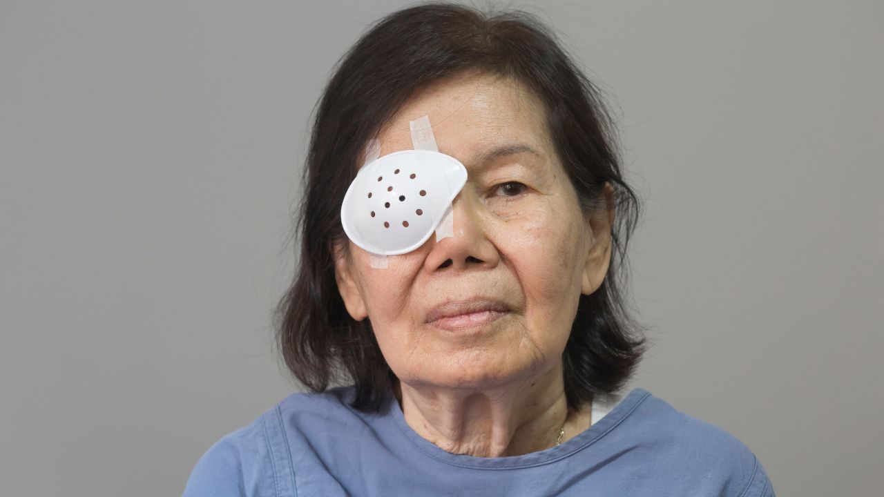 Cara Membersihkan Mata Setelah Operasi Katarak