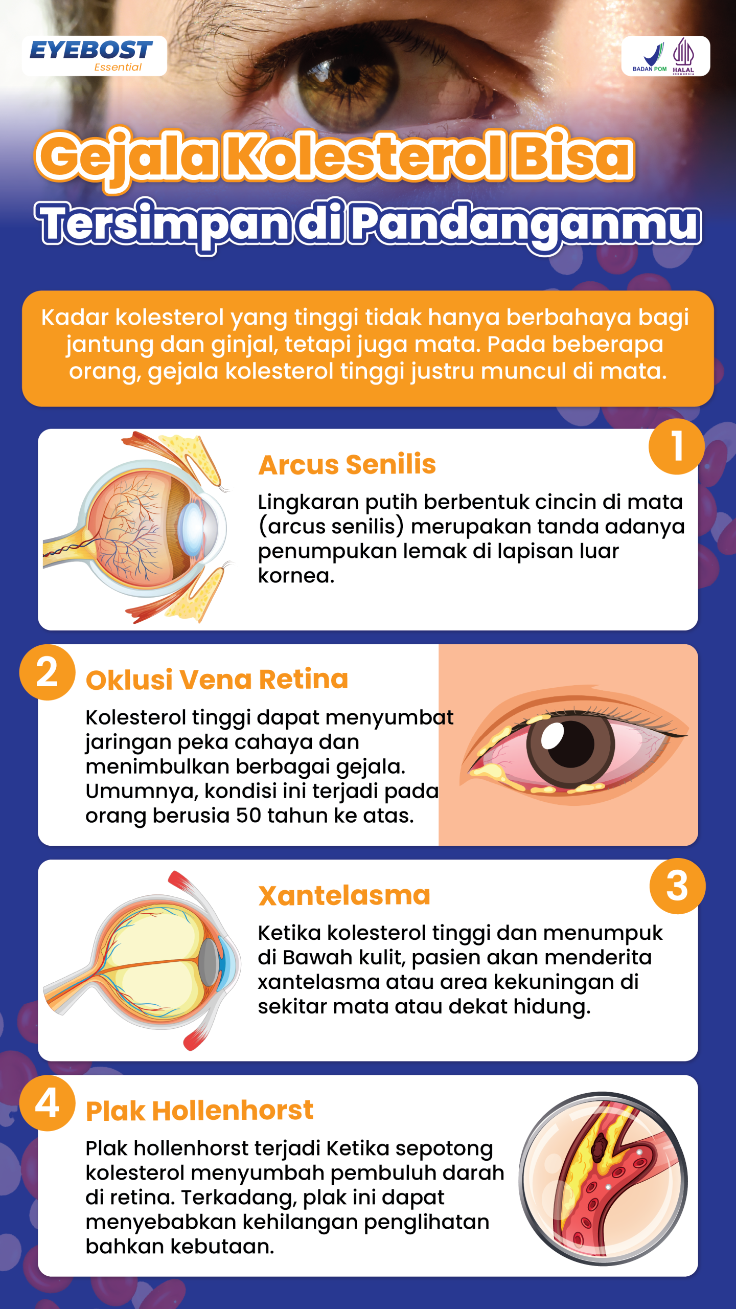infografis tanda kolesterol tinggi di mata