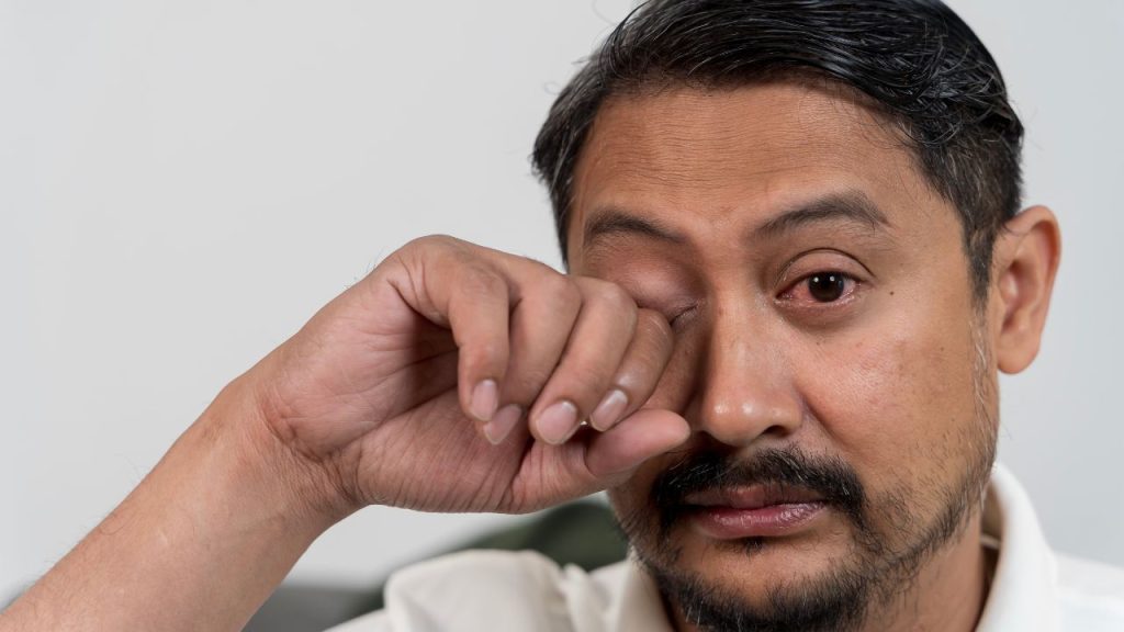 Faktor Risiko Iritasi Mata Ringan dan Cara Mencegahnya