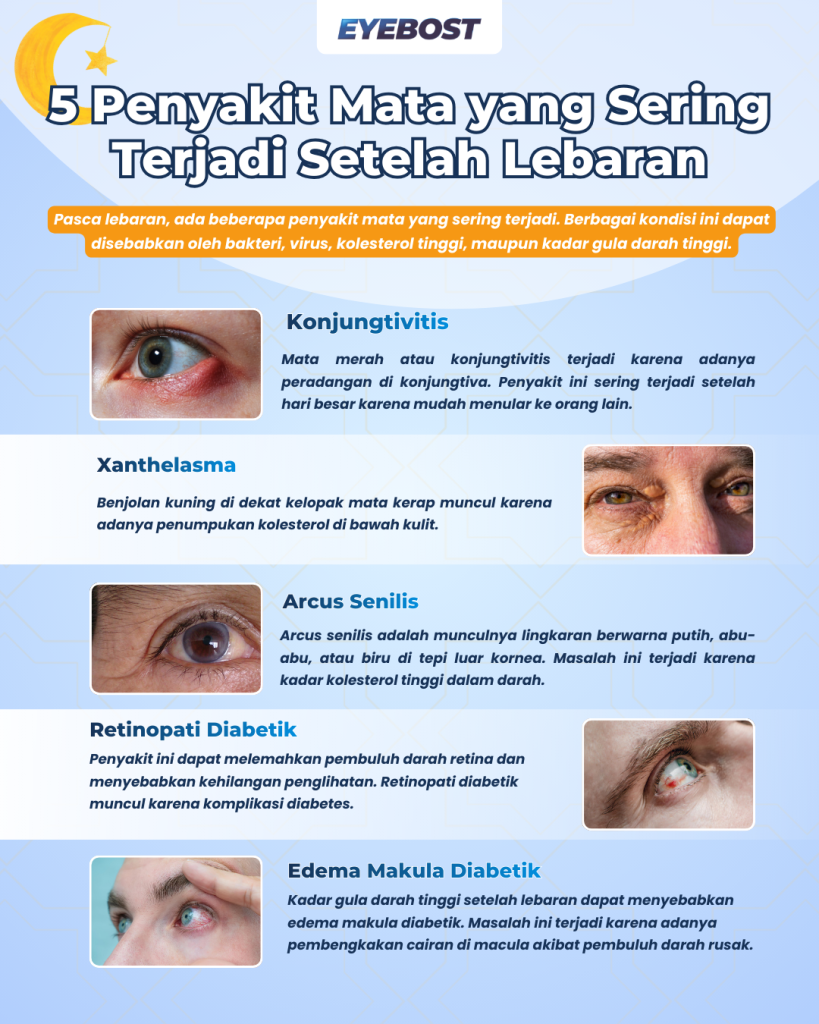Infografis Penyakit Mata yang Sering Terjadi Setelah Lebaran