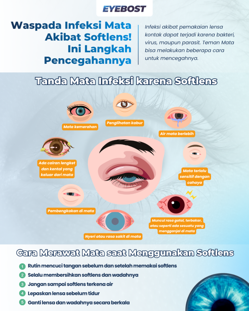 Infografis Waspada Infeksi Mata Akibat Softlens! Infografis Waspada Infeksi Mata Akibat Softlens!