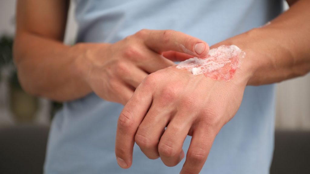 Jenis Obat Yang Tidak Membatalkan Puasa