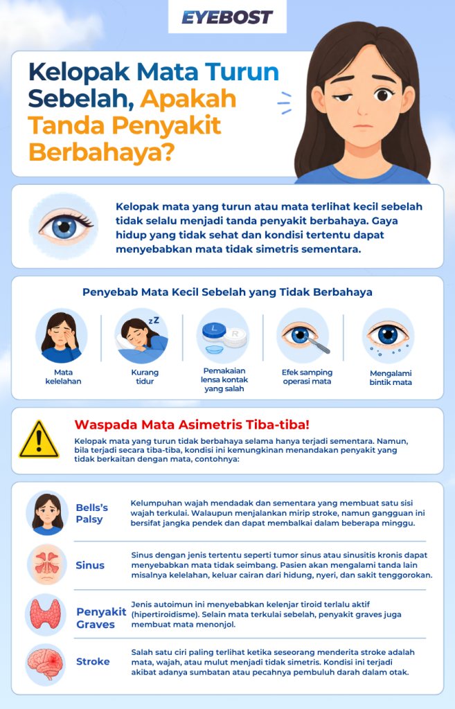 Infografis Kelopak Mata Turun Sebelah