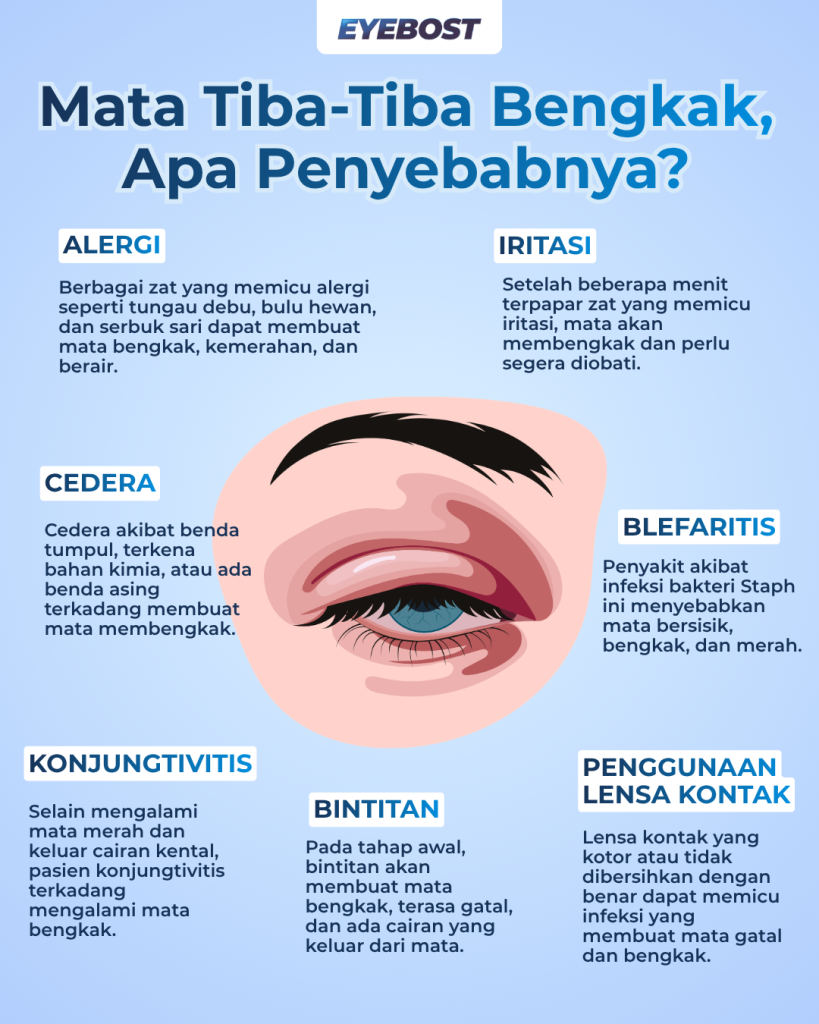 Infografis Mata Tiba-Tiba Bengkak